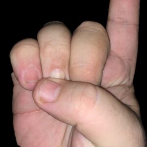 IMG 0106 1  Thumbnail